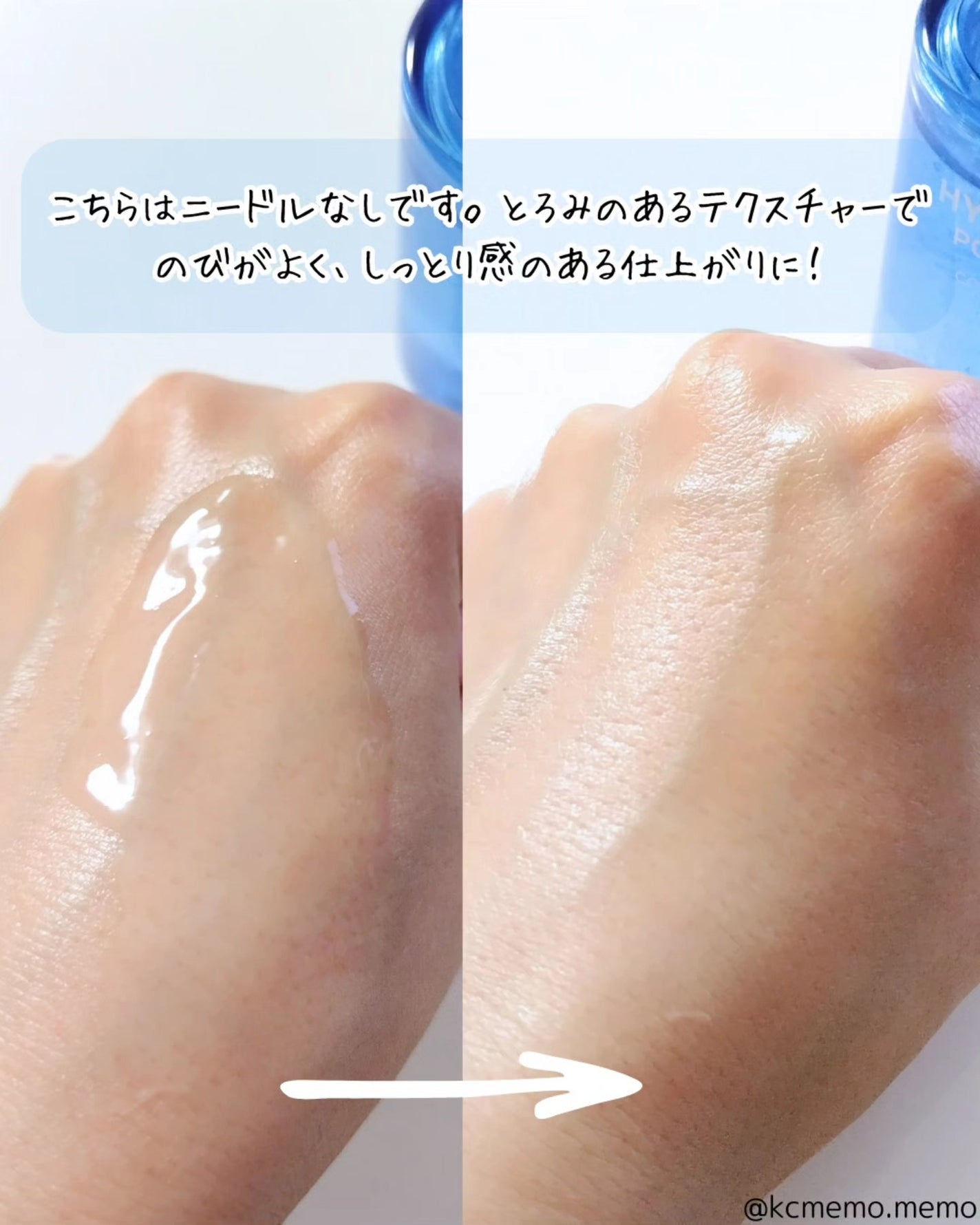 メモ魔ちゃん@韓国コスメメモ日記 on LIPS 「韓国初の見えるヒアルロン酸ニードル!本日のメモ✍️Snp♡コレ..」(9枚目)