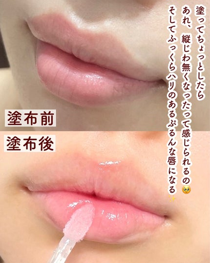 ジルスチュアート クリスタルブルーム リップブーケ セラム/JILL STUART/リッププランパーを使ったクチコミ(4枚目)