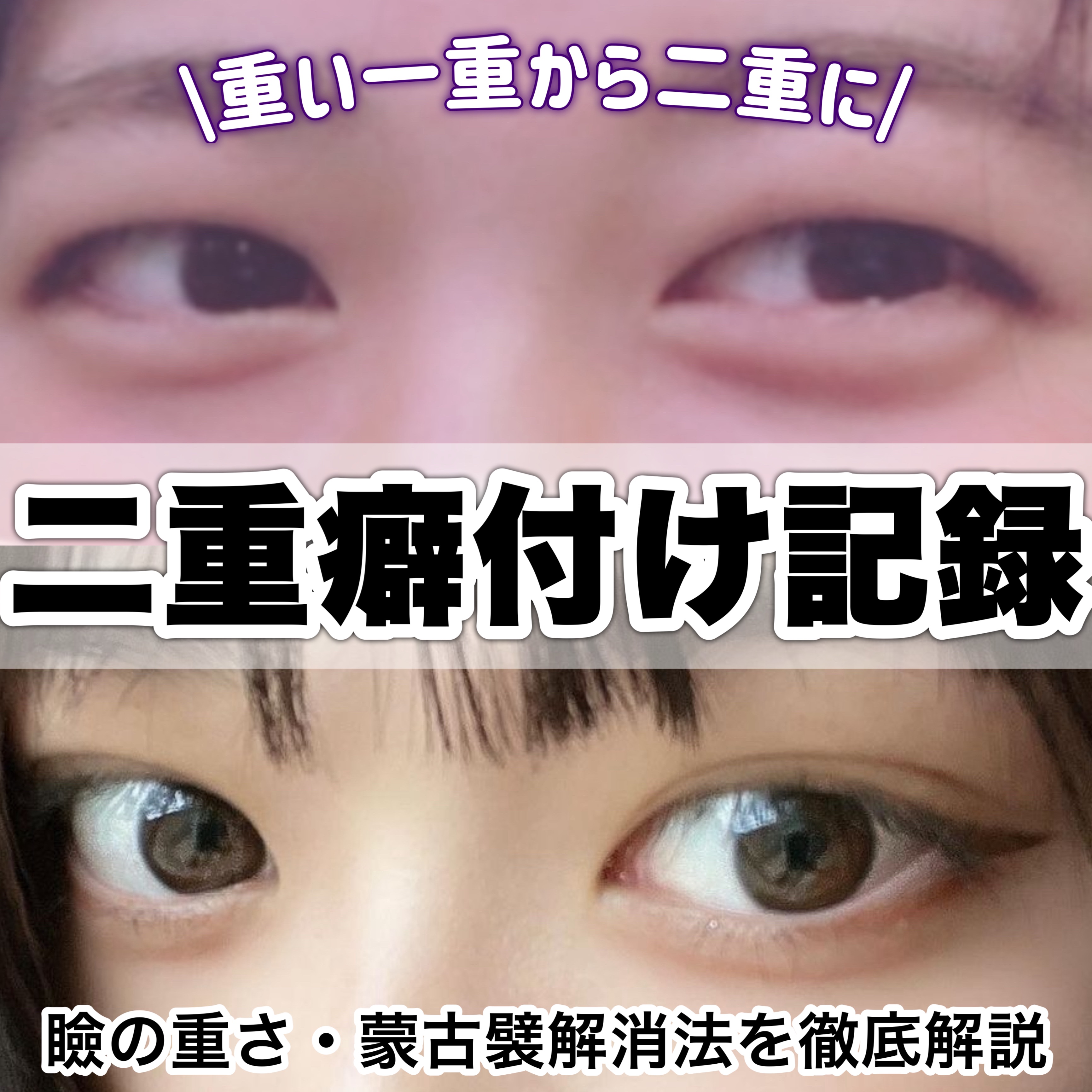 ワンダーアイリッドテープ Extra/D-UP/二重まぶた用アイテムを使ったクチコミ（1枚目）