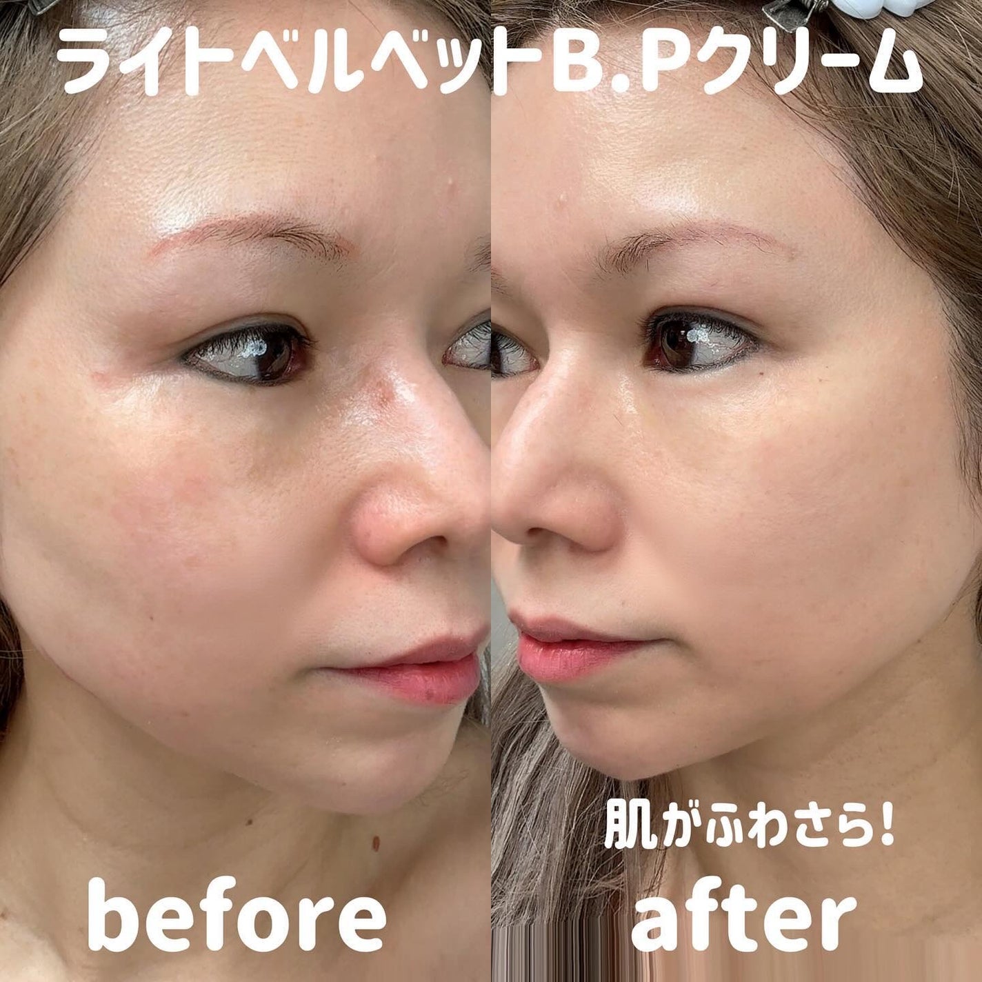 Ultra Whitening Perfect Ampoule/MIGUHARA/美容液を使ったクチコミ(8枚目)