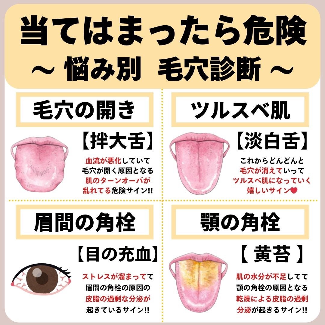 あなたの肌に合ったスキンケア💐コーくん先生 on LIPS 「【当てはまったらヤバい。】悩み別毛穴診断🤫..あなたの毛穴の開..」(1枚目)
