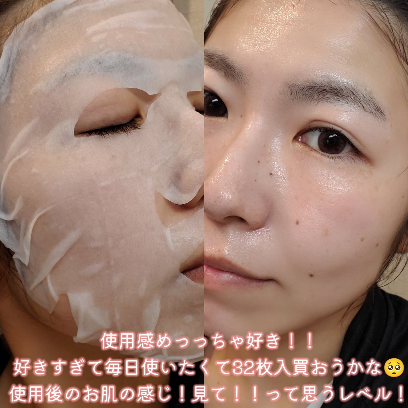 ルルルンピュア エブリーズ/ルルルン/シートマスク・パックを使ったクチコミ(5枚目)