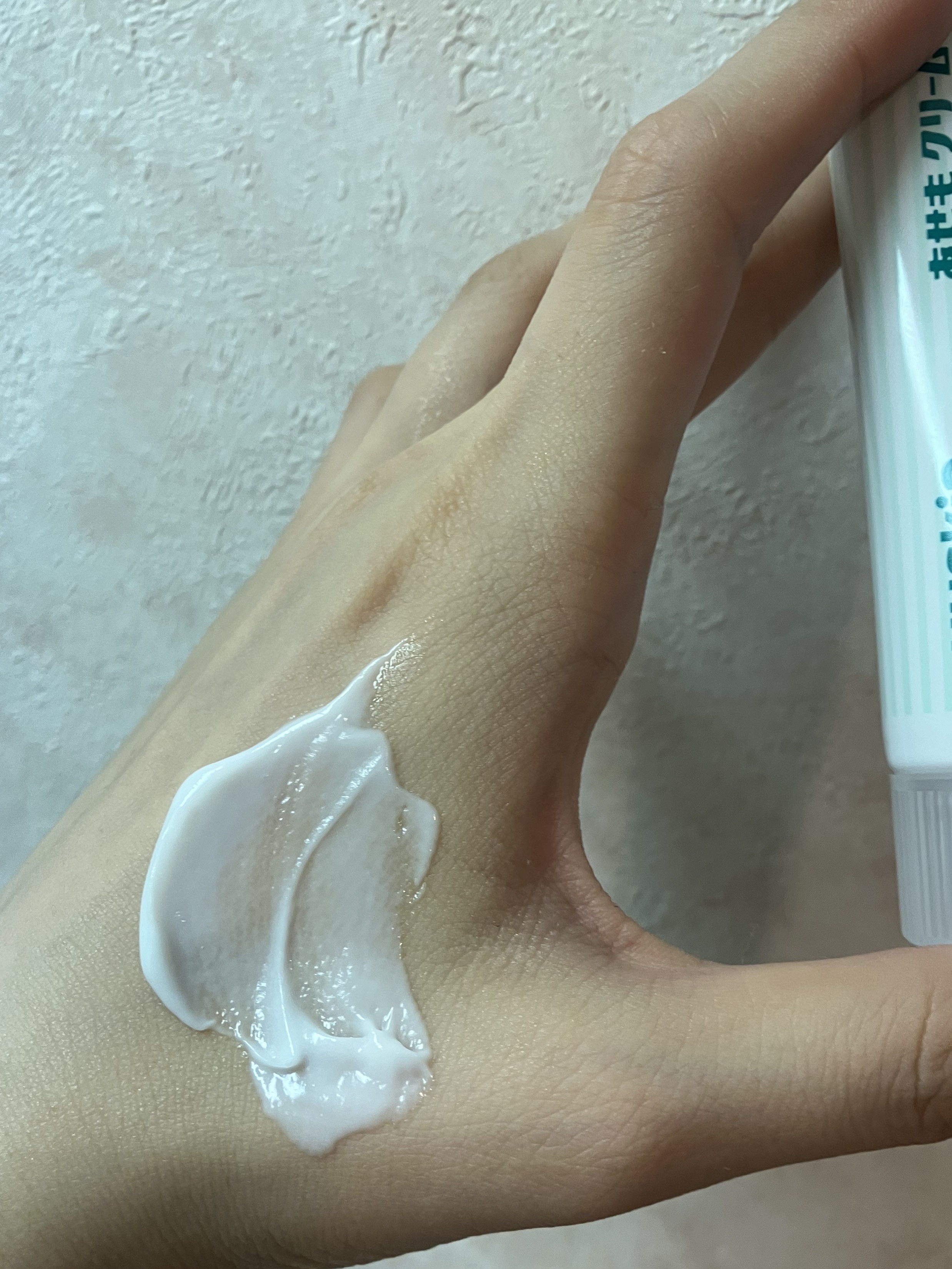 あせもクリーム(医薬品)/ユースキン/その他を使ったクチコミ（2枚目）