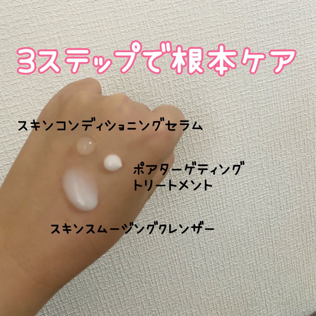 スマートセット/プロアクティブ/スキンケアキットを使ったクチコミ（2枚目）