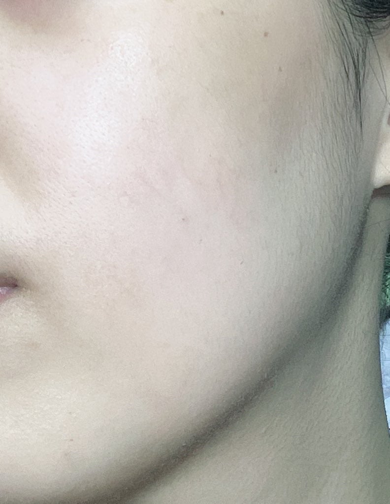 RMK Wトリートメントオイル/RMK/ブースター・導入液を使ったクチコミ(3枚目)