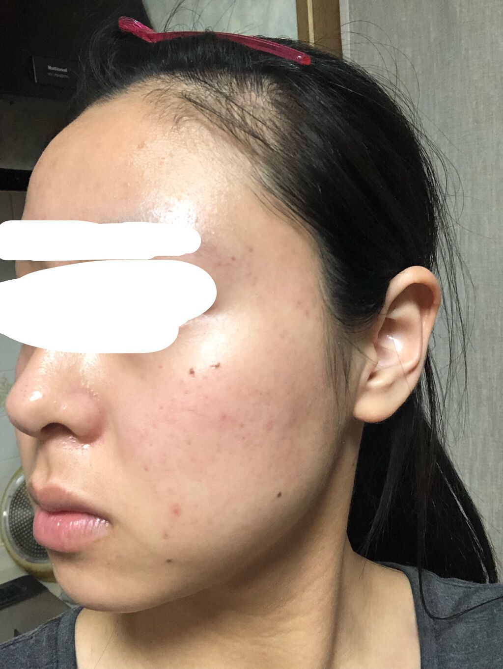 薬用しみ集中対策 プレミアム美容液/メラノCC/美容液を使ったクチコミ（2枚目）