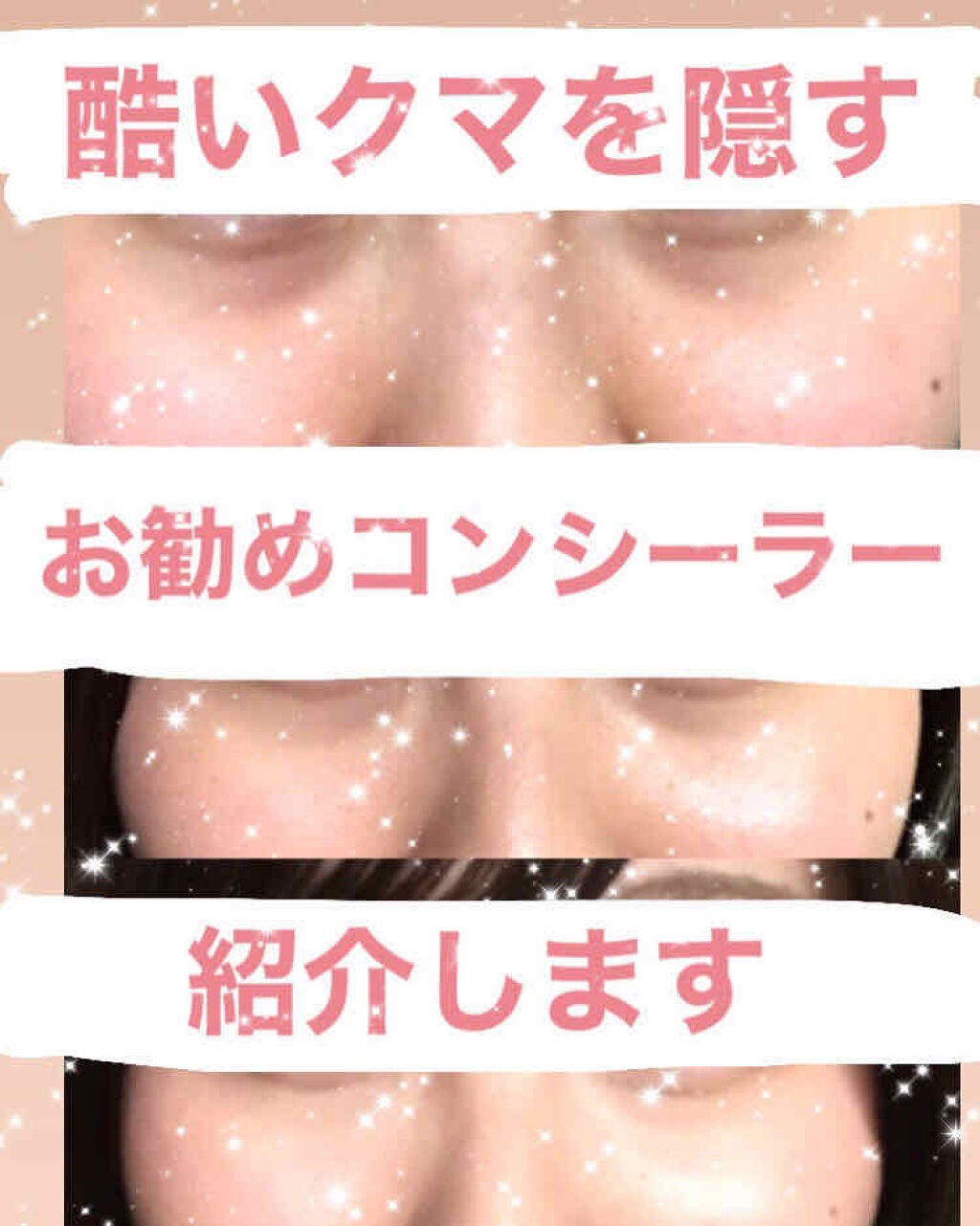 スポッツカバー ファウンデイション/SHISEIDO/クリームコンシーラーを使ったクチコミ(1枚目)