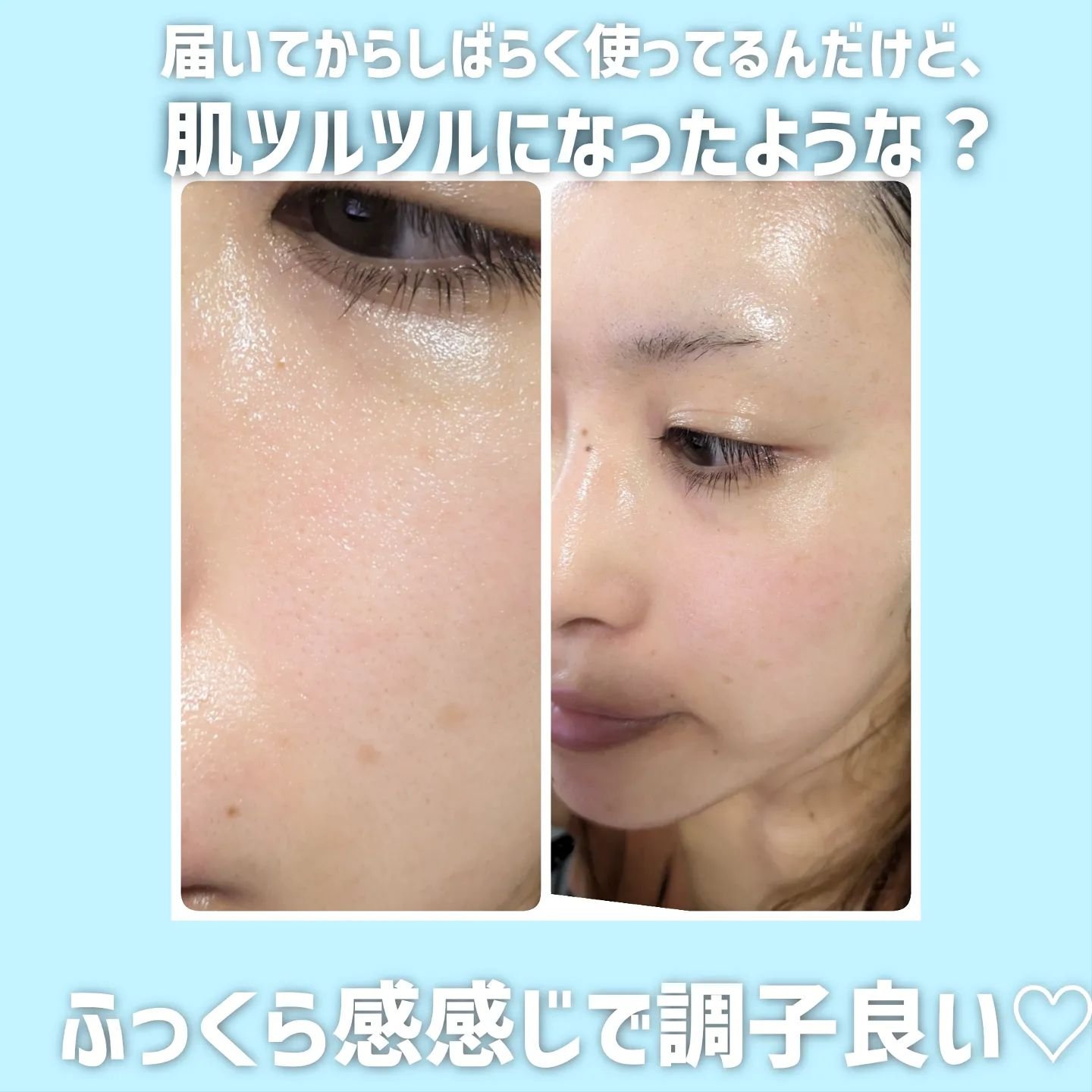 モイストケア ローション MB/d プログラム/化粧水を使ったクチコミ（3枚目）