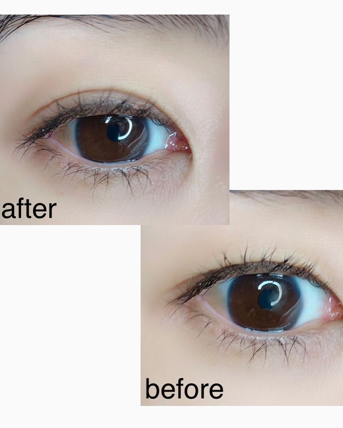 メザイク クリップ カッター ファイバー専用カッター/メザイク/二重まぶた用アイテムを使ったクチコミ(5枚目)