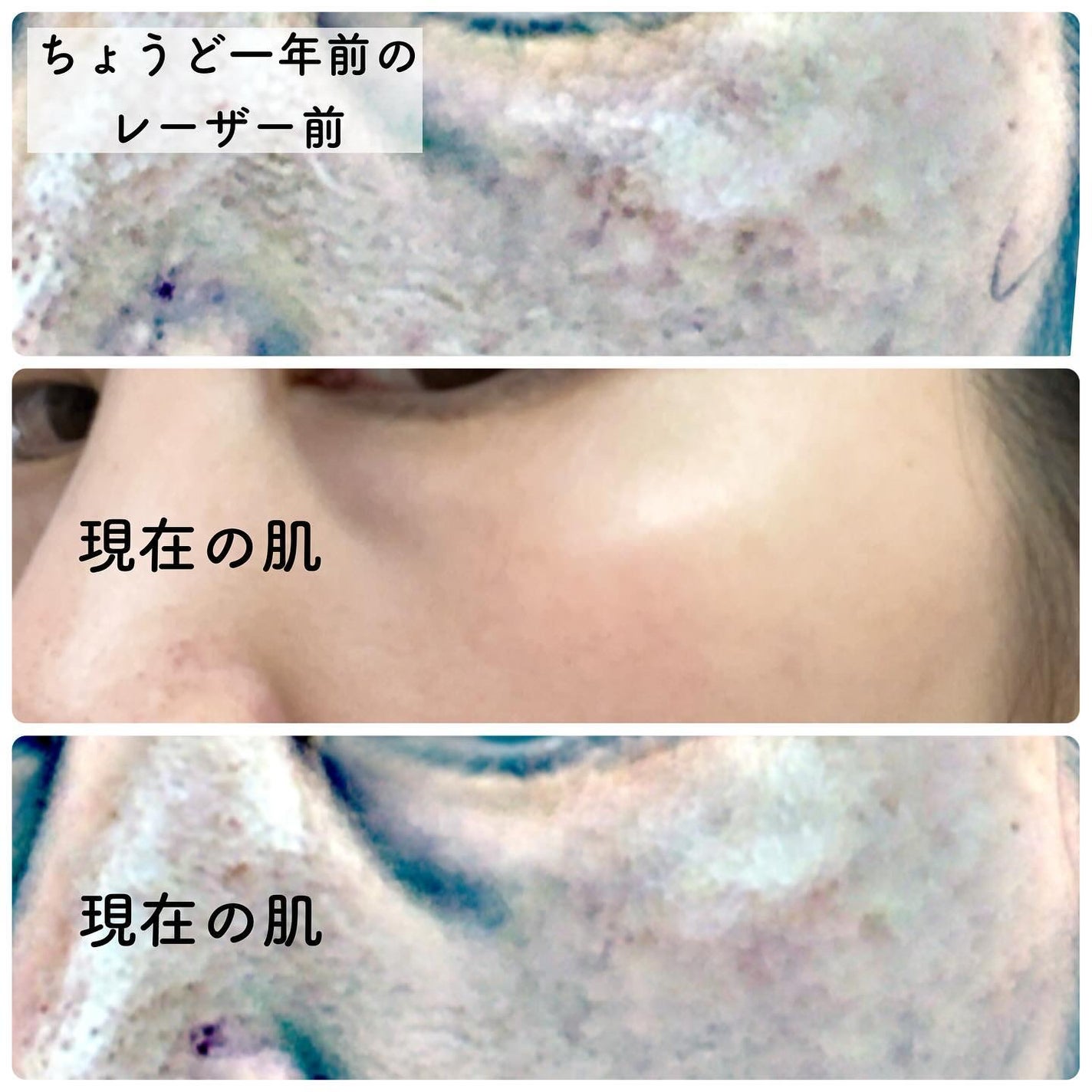 SBC ナノメソッドHQ/SBC/フェイスクリームを使ったクチコミ(9枚目)