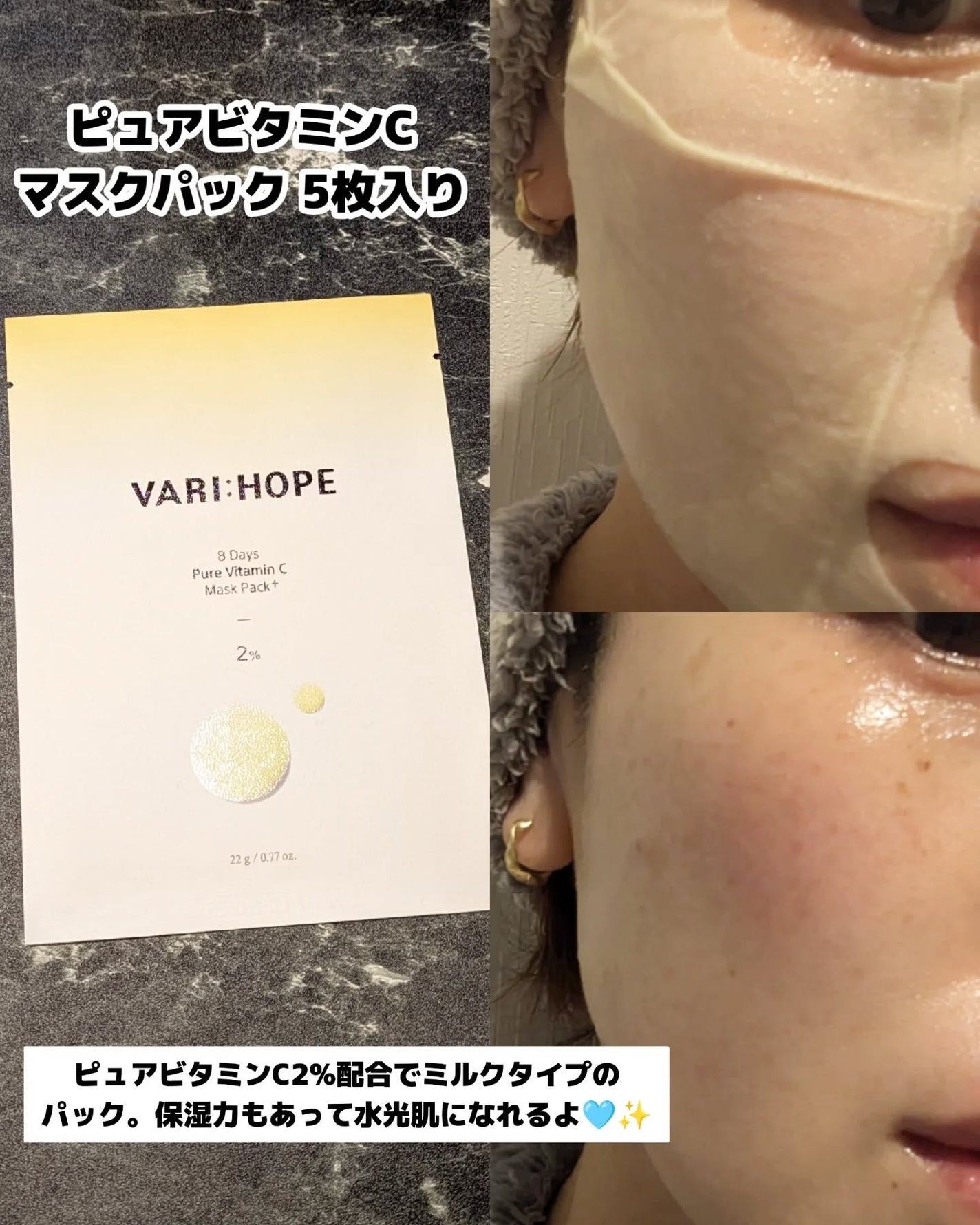 8デイズピュアビタミンCアンプル/VARI:HOPE/美容液を使ったクチコミ(4枚目)