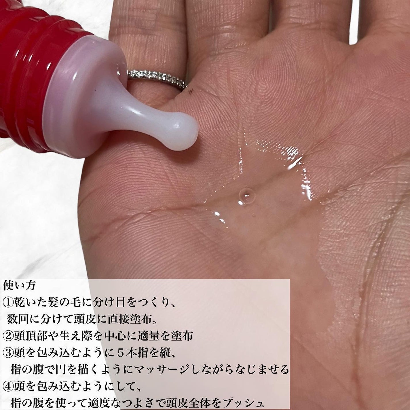 薬用 RJ地肌ケア エッセンス /アピセラピーコスメティクス/頭皮ローションを使ったクチコミ(3枚目)