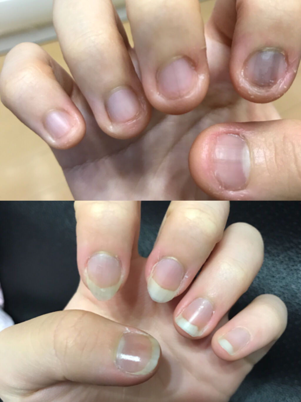 エテュセ クイックケアコート/ettusais/ネイルオイル・トリートメントを使ったクチコミ（2枚目）