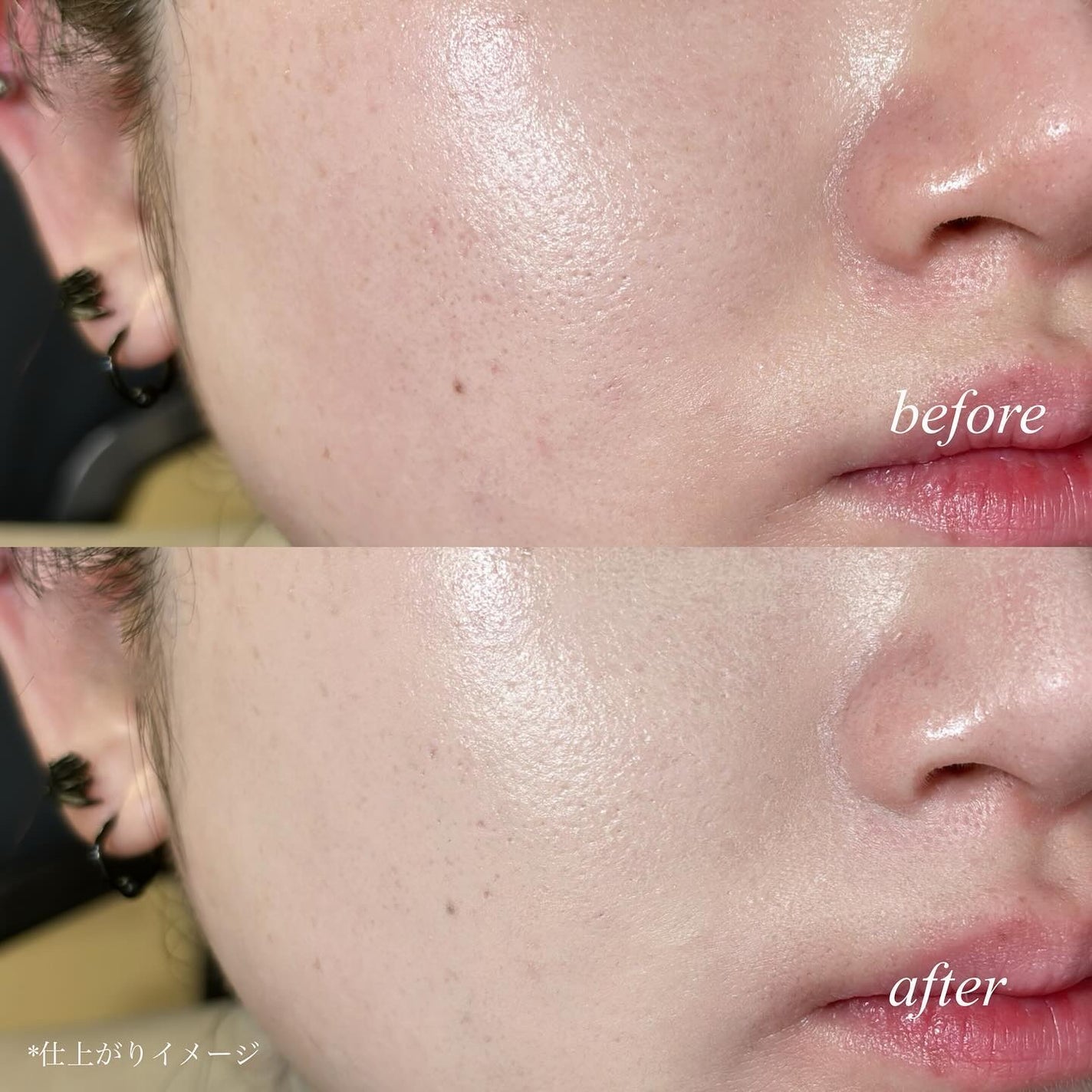 F5 リフレッシュクッション/keybo/クッションファンデーションを使ったクチコミ(5枚目)