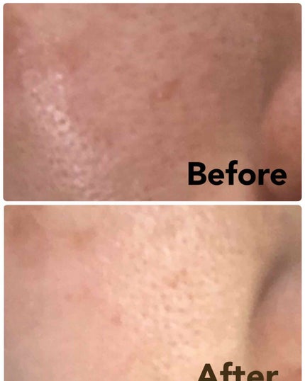 ルルルンピュア 白(クリア)/ルルルン/シートマスク・パックを使ったクチコミ(2枚目)