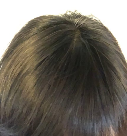 Wアプローチヘアプログラム/MUNOAGE(ミューノアージュ)/頭皮ローションを使ったクチコミ(10枚目)