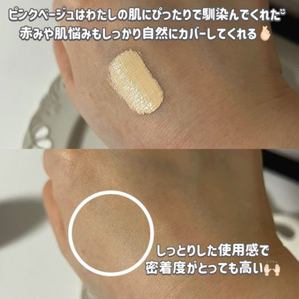 ダーマシンコンシーラー/23years old/リキッドコンシーラーを使ったクチコミ(3枚目)