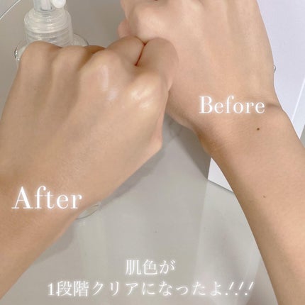 SUHADA MIST/U-flat/その他洗顔料を使ったクチコミ(3枚目)