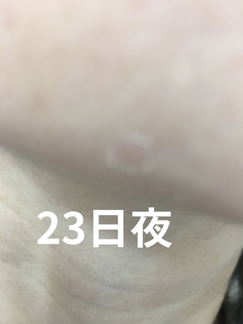 レチノールA 1% アドバンスドリバイタリゼーションクリーム/Life-flo/フェイスクリームを使ったクチコミ（2枚目）