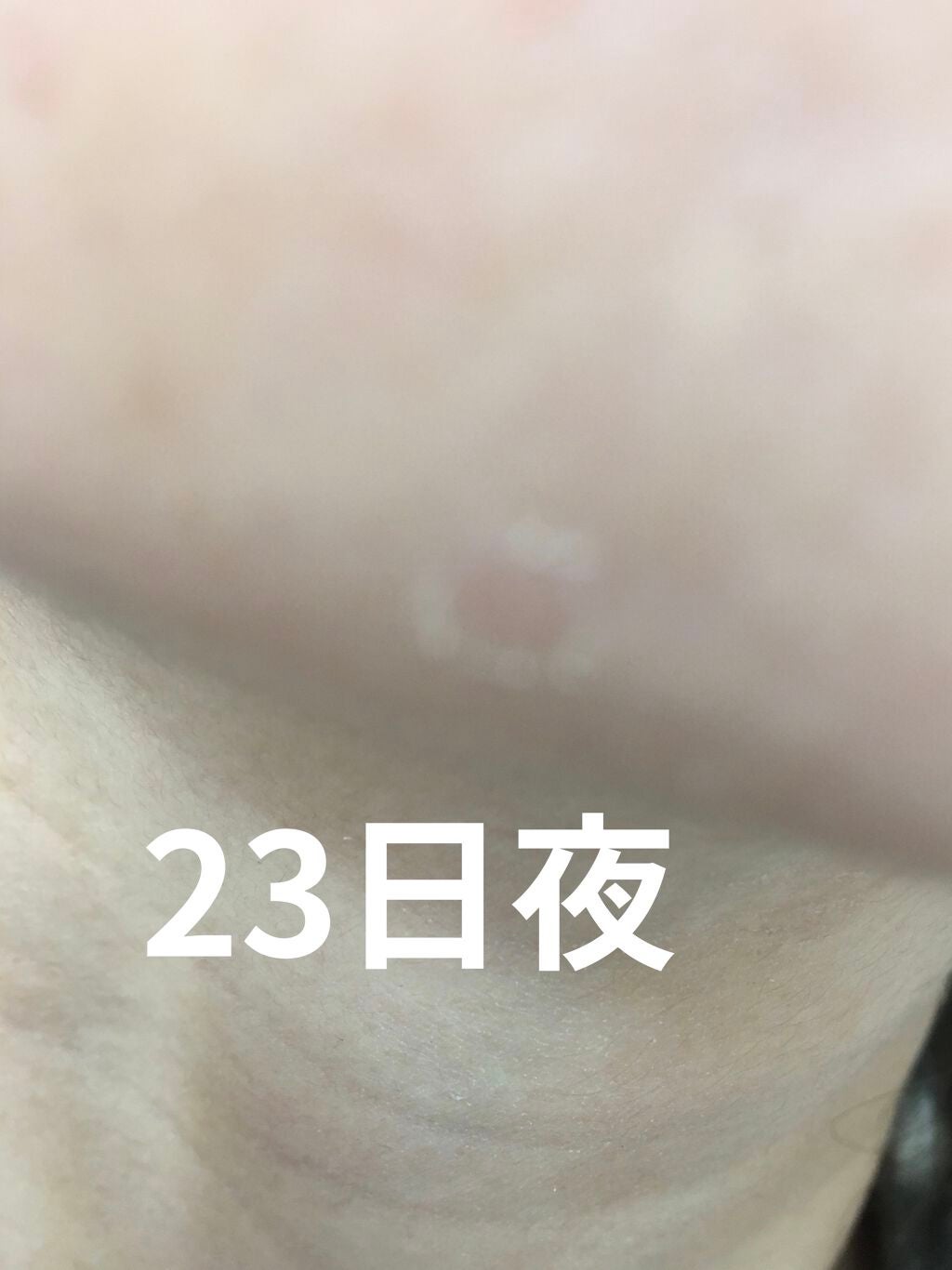 レチノールA 1% アドバンスドリバイタリゼーションクリーム/Life-flo/フェイスクリームを使ったクチコミ(2枚目)