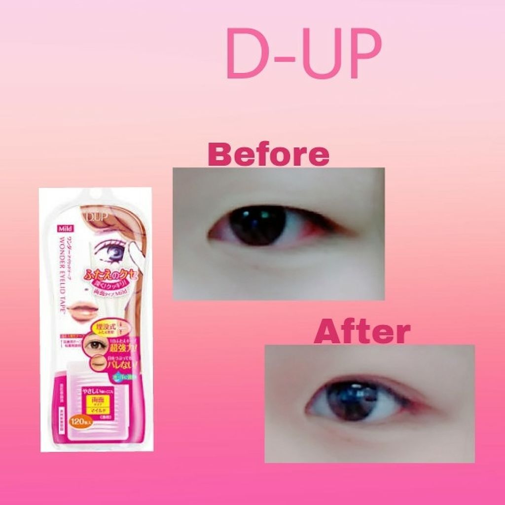 ワンダーアイリッドテープ Mild/D-UP/二重まぶた用アイテムを使ったクチコミ(2枚目)