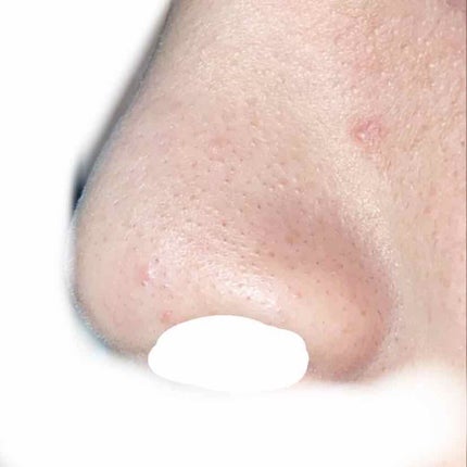 オリジナル ピュアスキンジェリー/ヴァセリン/ボディクリームを使ったクチコミ(2枚目)