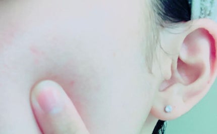 【馬プラセンタ原液100】プラセンタ原液100美容液 パウチ 1ml (馬プラセンタ)/パーフェクトC/美容液を使ったクチコミ(2枚目)