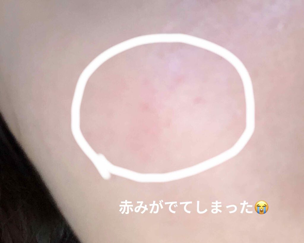 ソフティモ ホワイト クレンジングオイル/ソフティモ/オイルクレンジングを使ったクチコミ(2枚目)