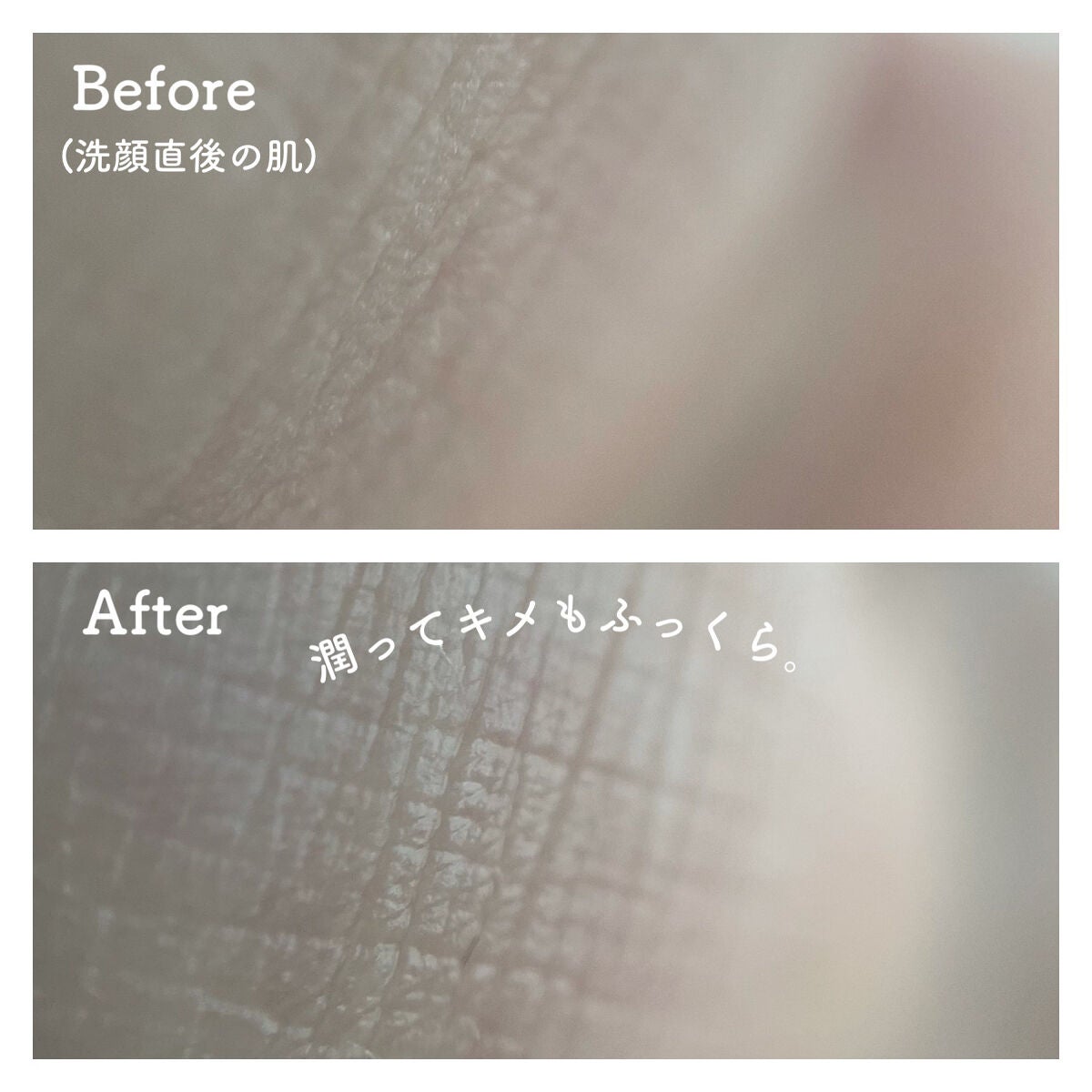 フローラドリップ/ALBION/化粧水を使ったクチコミ(4枚目)