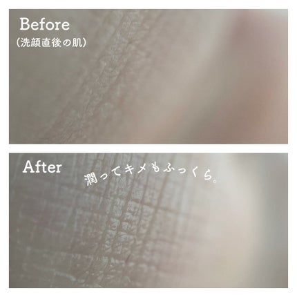 フローラドリップ/ALBION/化粧水を使ったクチコミ(4枚目)