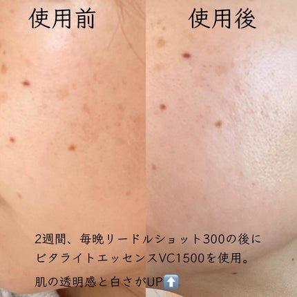 リードルショット300/VT/美容液を使ったクチコミ(4枚目)