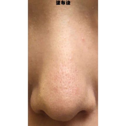 ホワイト パウダレスト/ALBION/パウダーファンデーションを使ったクチコミ(3枚目)