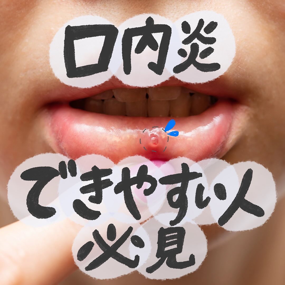 チョコラBBプラス (医薬品)/チョコラBB/その他を使ったクチコミ（1枚目）