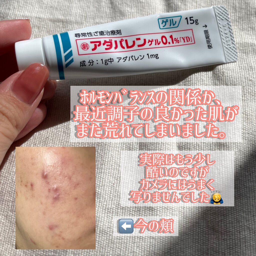 を使ったクチコミ（2枚目）