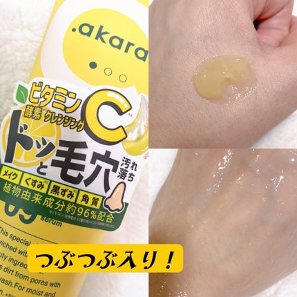 ビタバランスジェルクレンジング/.akaran/クレンジングジェルを使ったクチコミ(2枚目)