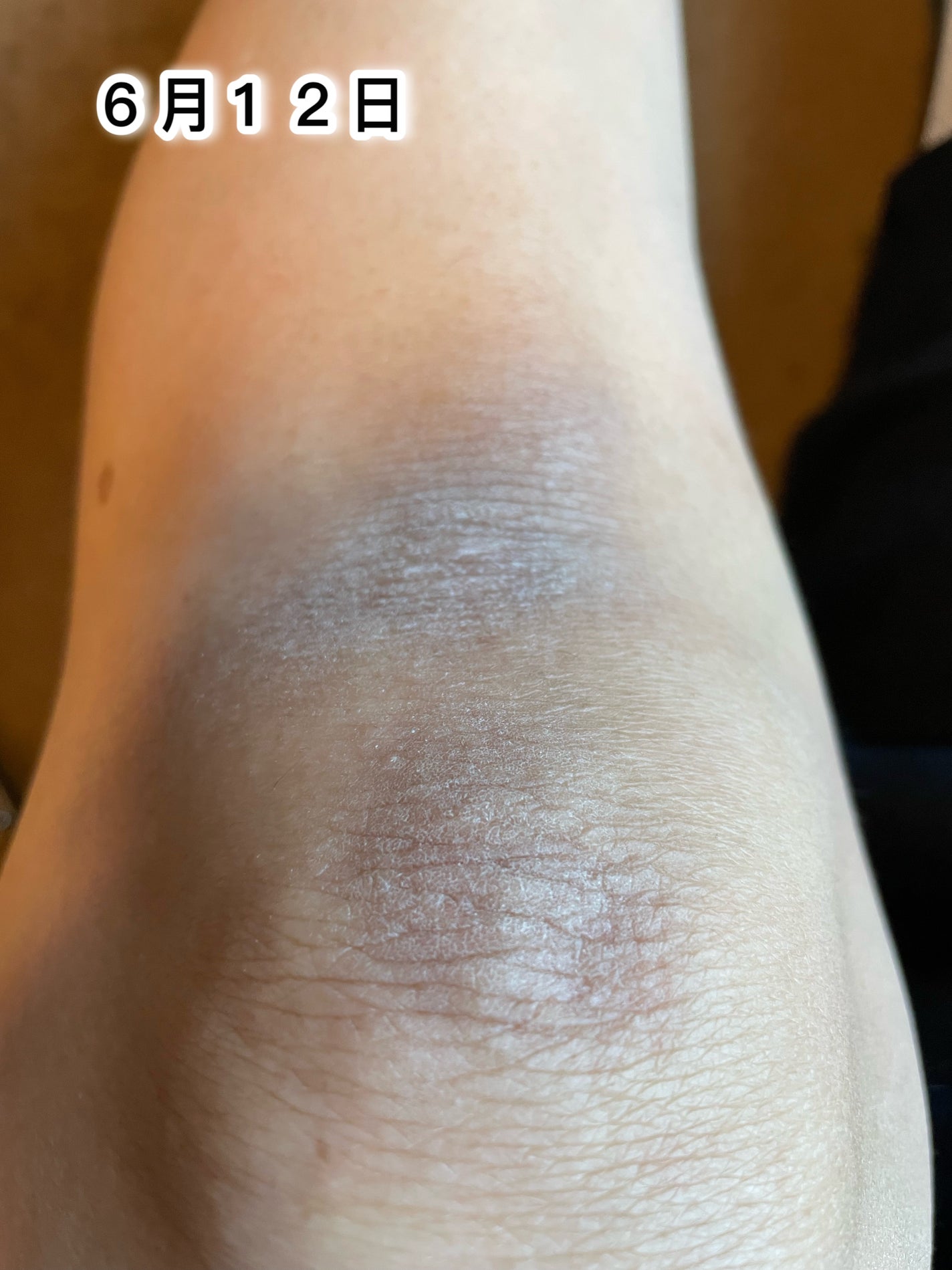 マイクワゾウスキ【フォロバ100%】 on LIPS 「おはようございます。汚い写真ですみません。私、油断すると片膝だ..」(2枚目)