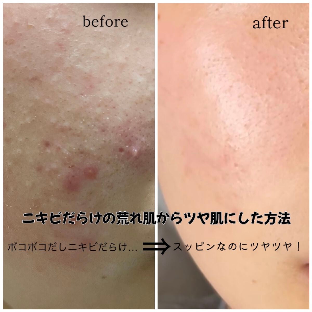 黒真珠マスク/我的美麗日記/シートマスク・パックを使ったクチコミ(1枚目)