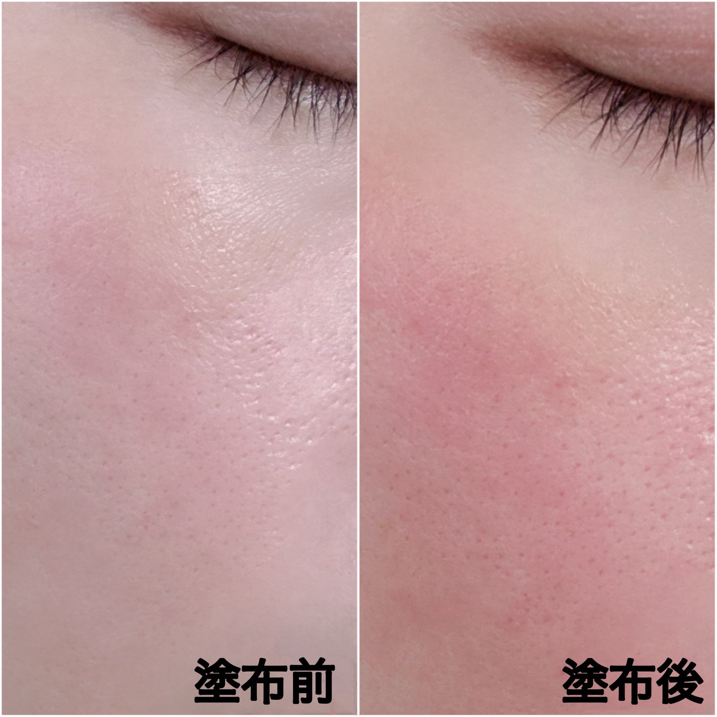 マイルドリードルショット50/VT/美容液を使ったクチコミ(5枚目)