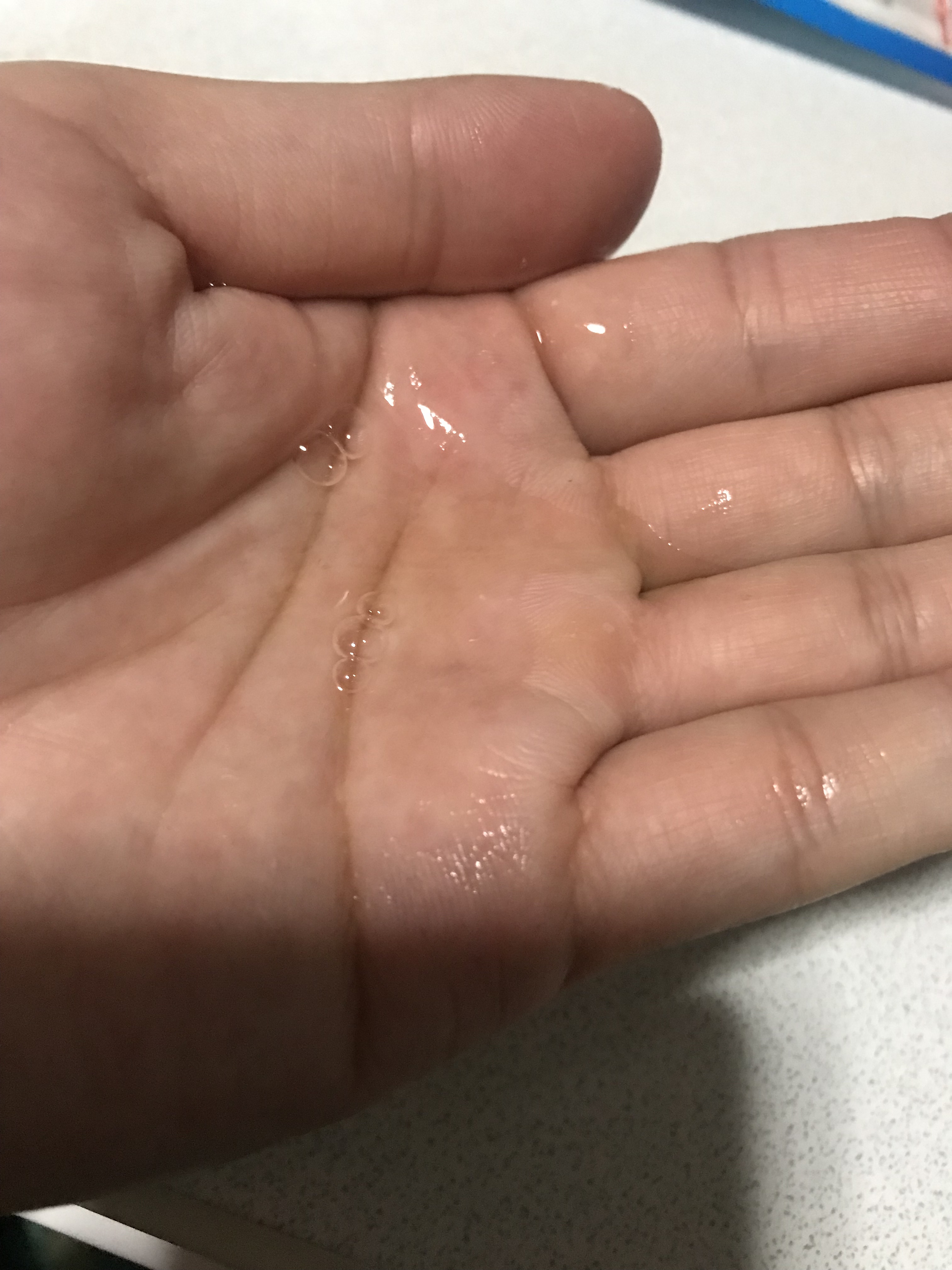 センテラ アンプル/SKIN1004/美容液を使ったクチコミ（2枚目）