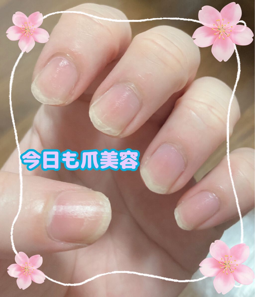 ネイルトリートメント N/ネイルネイル/ネイルオイル・トリートメントを使ったクチコミ(1枚目)