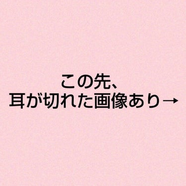 白色ワセリン(医薬品)/健栄製薬/その他を使ったクチコミ（2枚目）