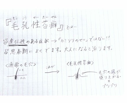 ケアノキュア(医薬品)/小林製薬/その他を使ったクチコミ(2枚目)