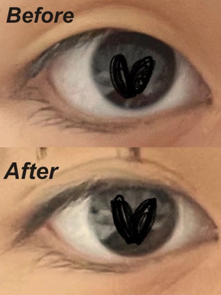 TWOOL ダブルアイリッドグルー/SHOBIDO/二重まぶた用アイテムを使ったクチコミ(2枚目)