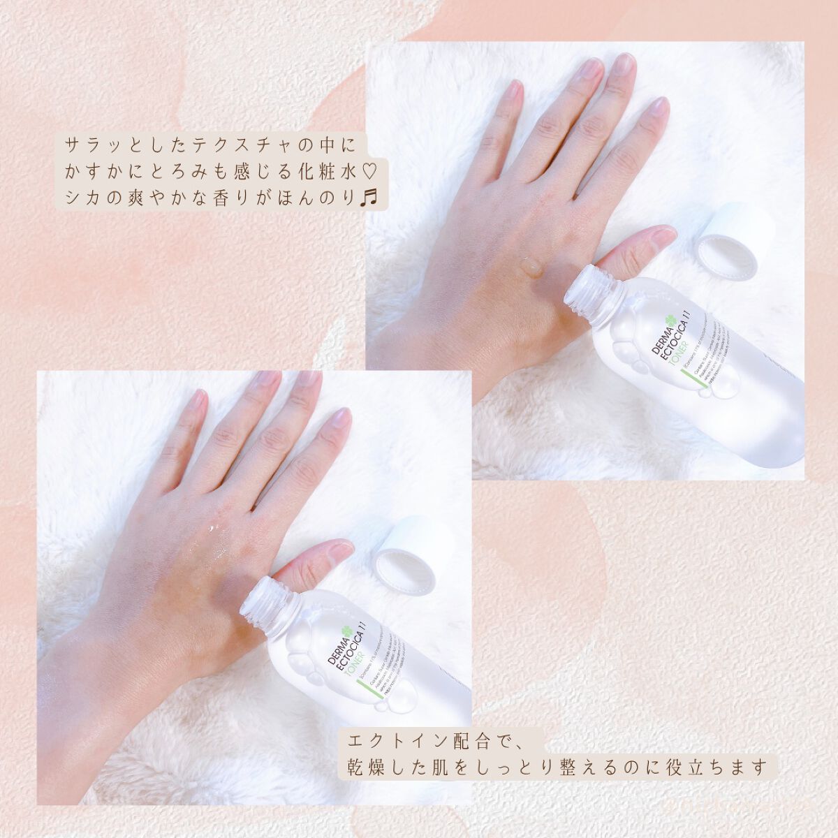 アトパインクリーム/Neulii/フェイスクリームを使ったクチコミ（3枚目）