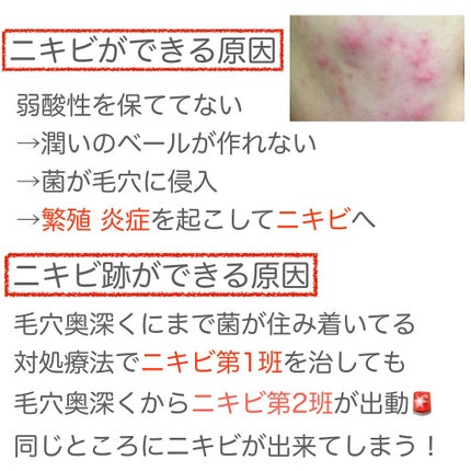 みん on LIPS 「肌荒れしてる方ならば1度は行ったことがあるであろう皮膚科につい..」(4枚目)