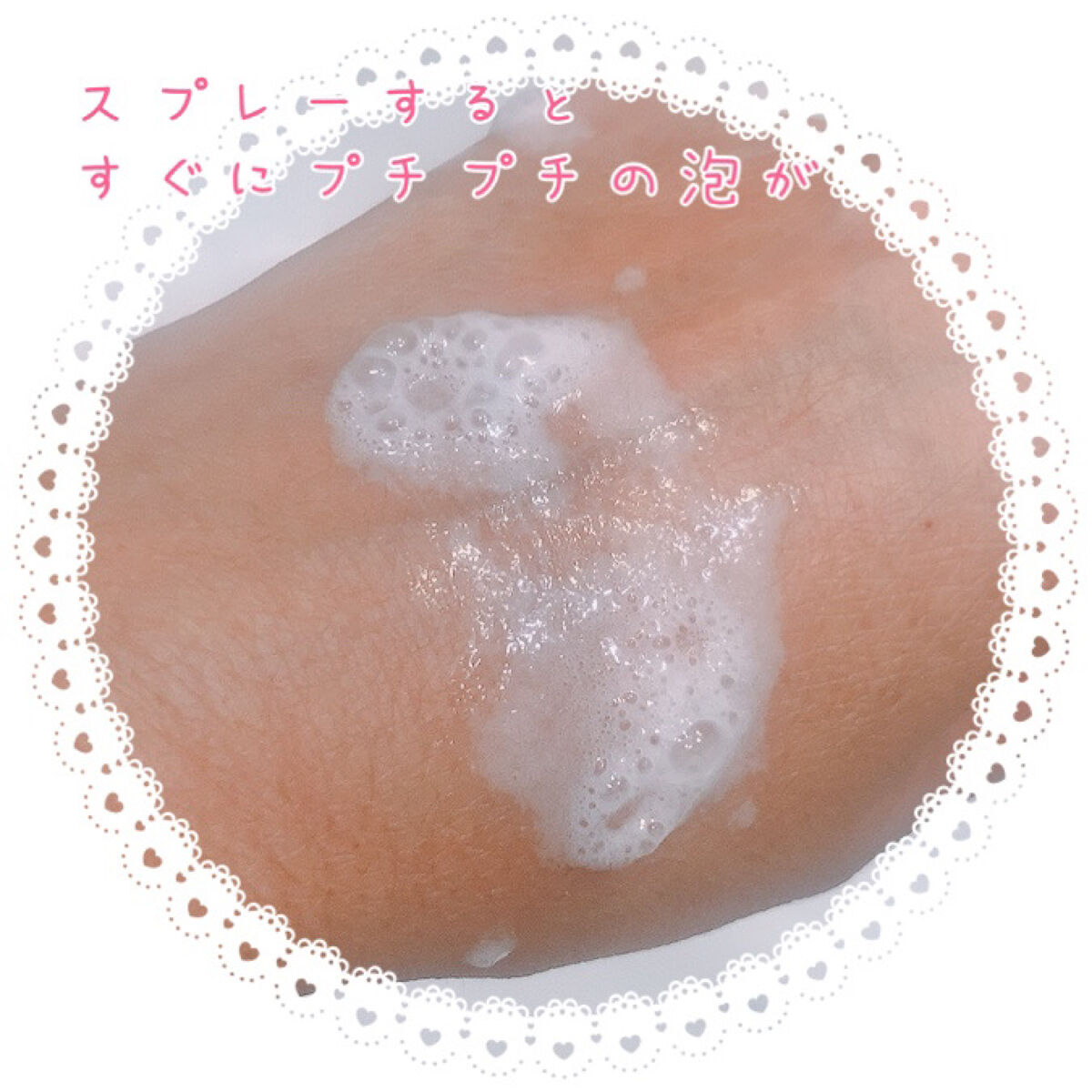 薬用スパークリング スカルプケア/ドクターベルツ/頭皮ローションを使ったクチコミ（2枚目）