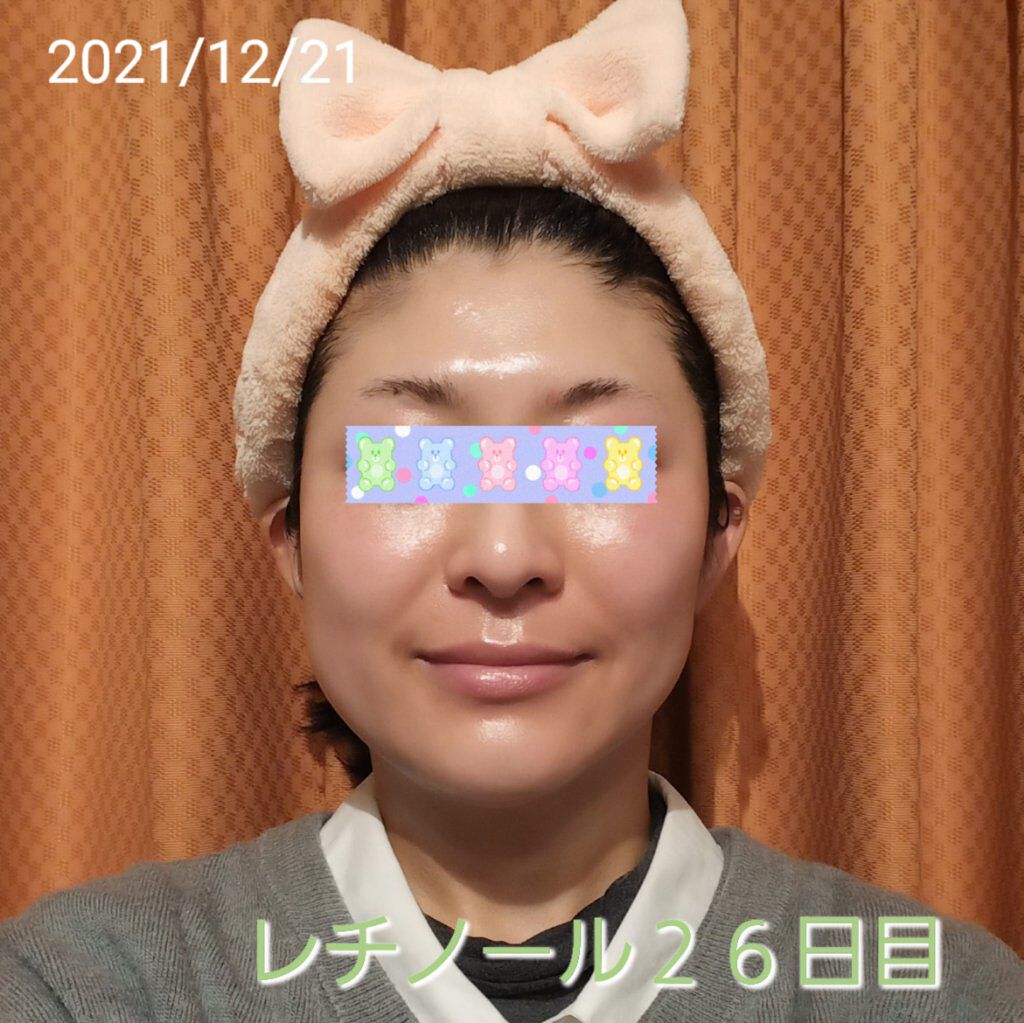 モイスチャーバーム ジャー/キュレル/フェイスクリームを使ったクチコミ（1枚目）