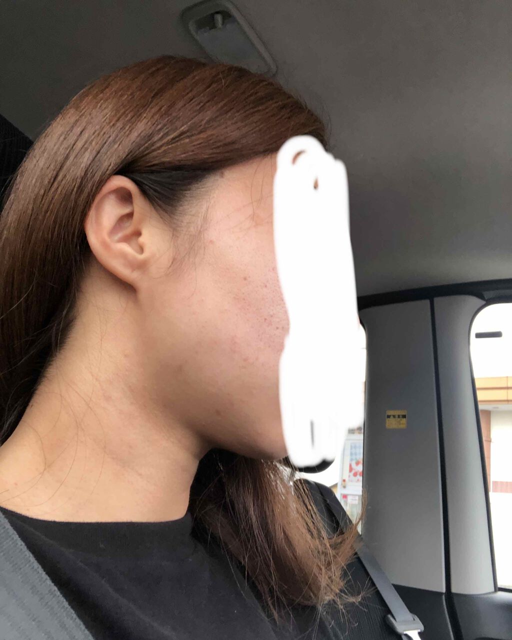 薬用泡のふんわり洗顔/スキンライフ/泡洗顔を使ったクチコミ（1枚目）