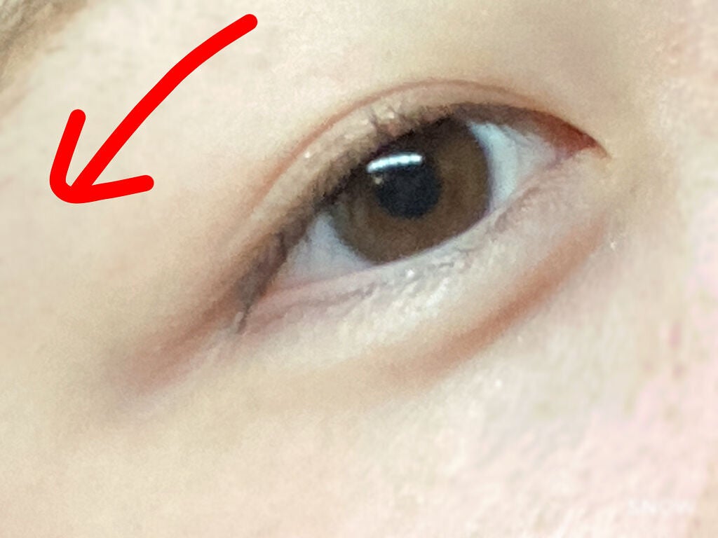 アイビューティー フィクサー WP/アストレア ヴィルゴ/二重まぶた用アイテムを使ったクチコミ(2枚目)