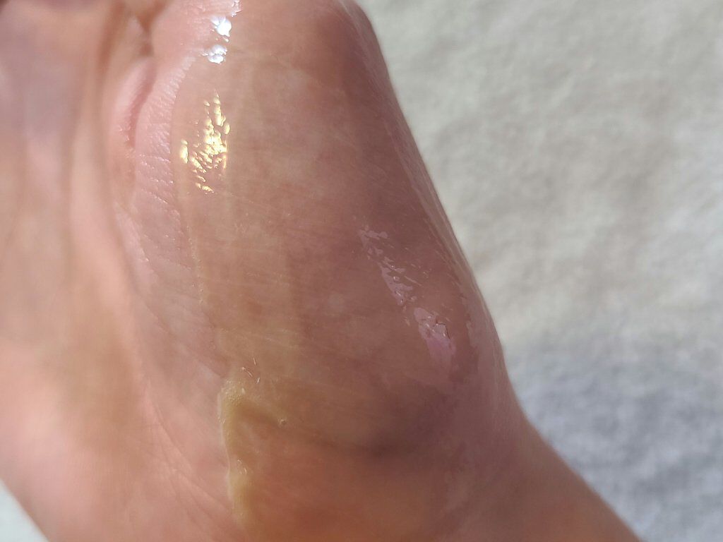 ビタミンACEセラム/APRILSKIN/美容液を使ったクチコミ（3枚目）